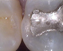 220px ZMO0287 001.wikipedia